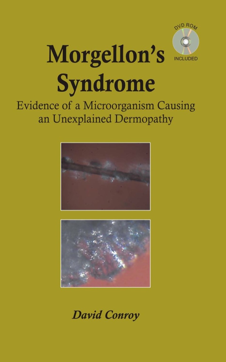 Morgellon's Syndrome