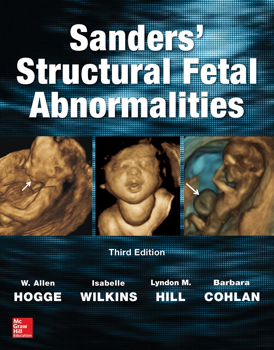 Sanders' Structural Fetal Abnormalities, Third Edition