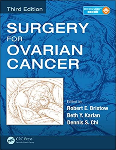 Surgery for Ovarian Cancer