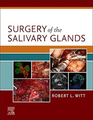 Surgery of the Salivary Glands, 1st Edition