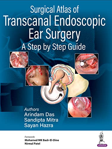 Surgical Atlas of Transcanal Endoscopic Ear Surgery: A Step by Step Guide