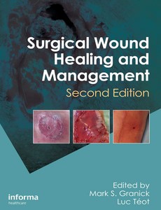 Surgical Wound Healing and Management 2nd Edition by Mark S. Granick