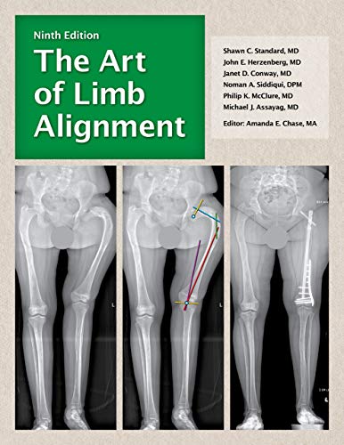 The Art of Limb Alignment, Ninth Edition