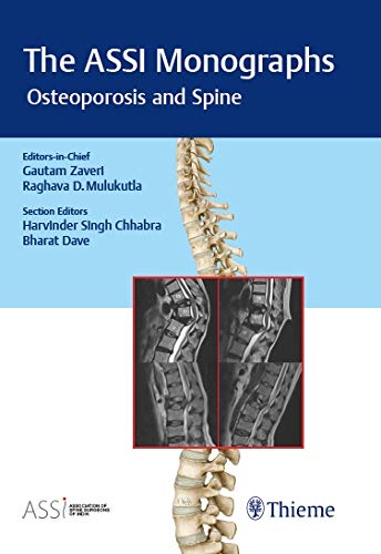 The ASSI Monographs : Osteoporosis And Spine