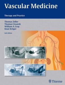 Vascular Medicine Therapy and Practice 2nd Edition by Thomas Zeller