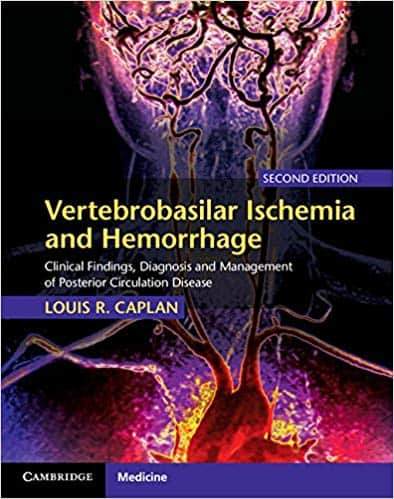Vertebrobasilar Ischemia and Hemorrhage: Clinical Findings, Diagnosis and Management of Posterior Circulation Disease (2nd Edition) ?