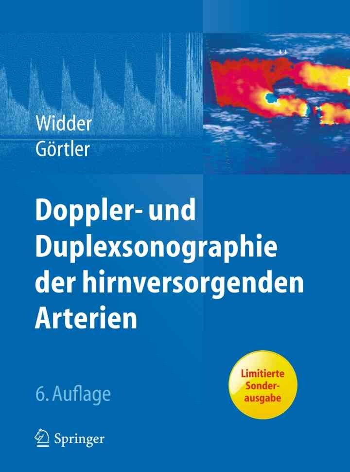 Doppler- und Duplexsonographie der hirnversorgenden Arterien