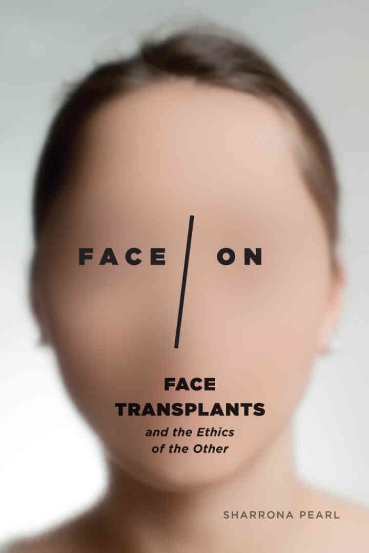Face/On: Face Transplants and the Ethics of the Other, 1st Edition